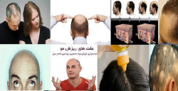 پژوهش و تحقیق بررسی پاوریوینت آموزش چگونگی تجویز محلول رویش مو و نحوه استفاده صحیح و کارساز در جهت رویش مو و توقف کامل ریزش مو با فرمول های مدرن و جد